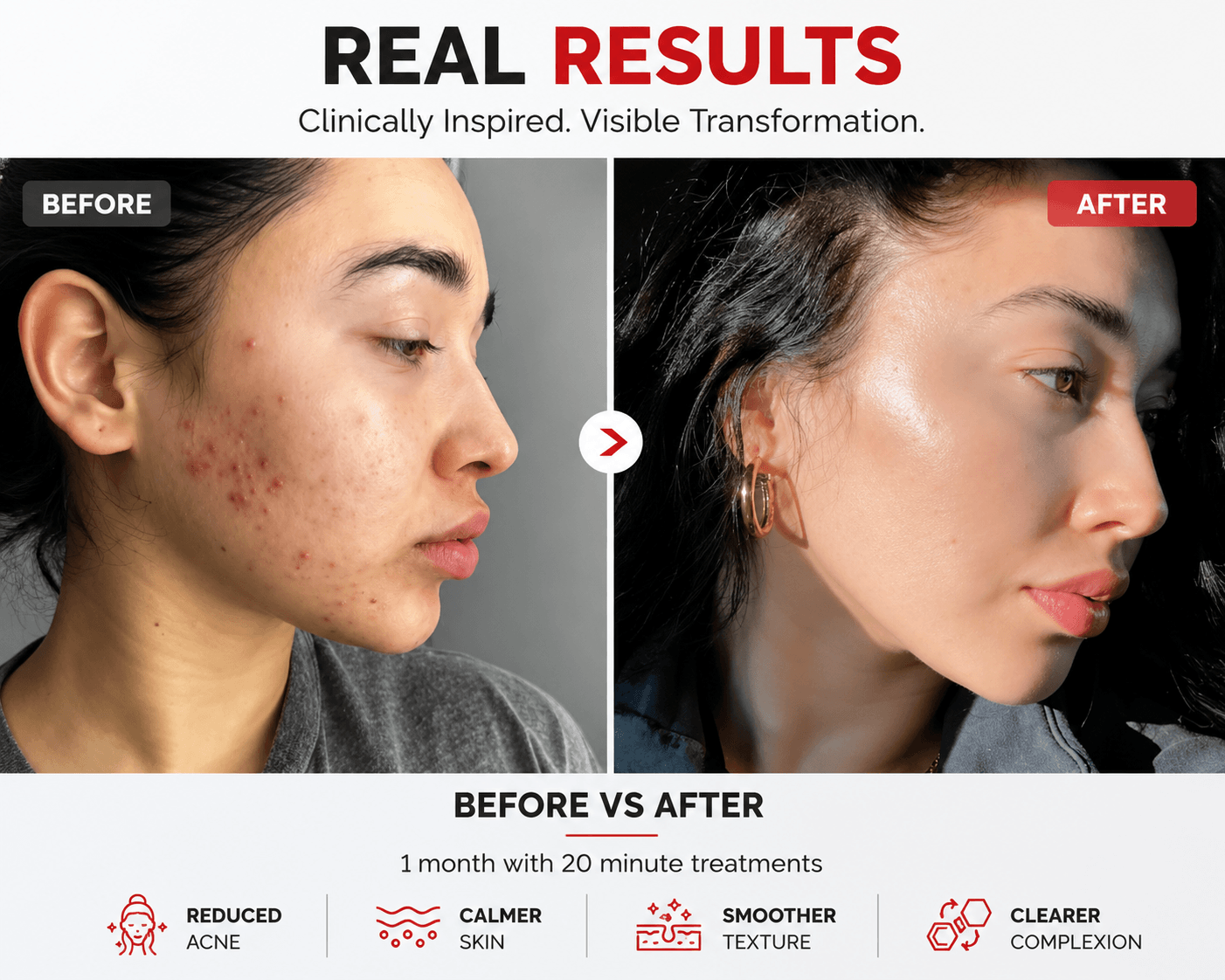 Lumara Red Light Therapy Mask