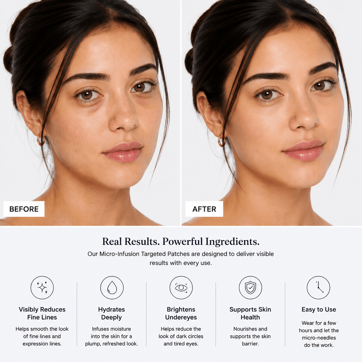 Microneedle Firming Eye Patches